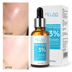 Ectoin Barrier Defense Serum – 3% Extremolyte Recovery & Anti-Pollution