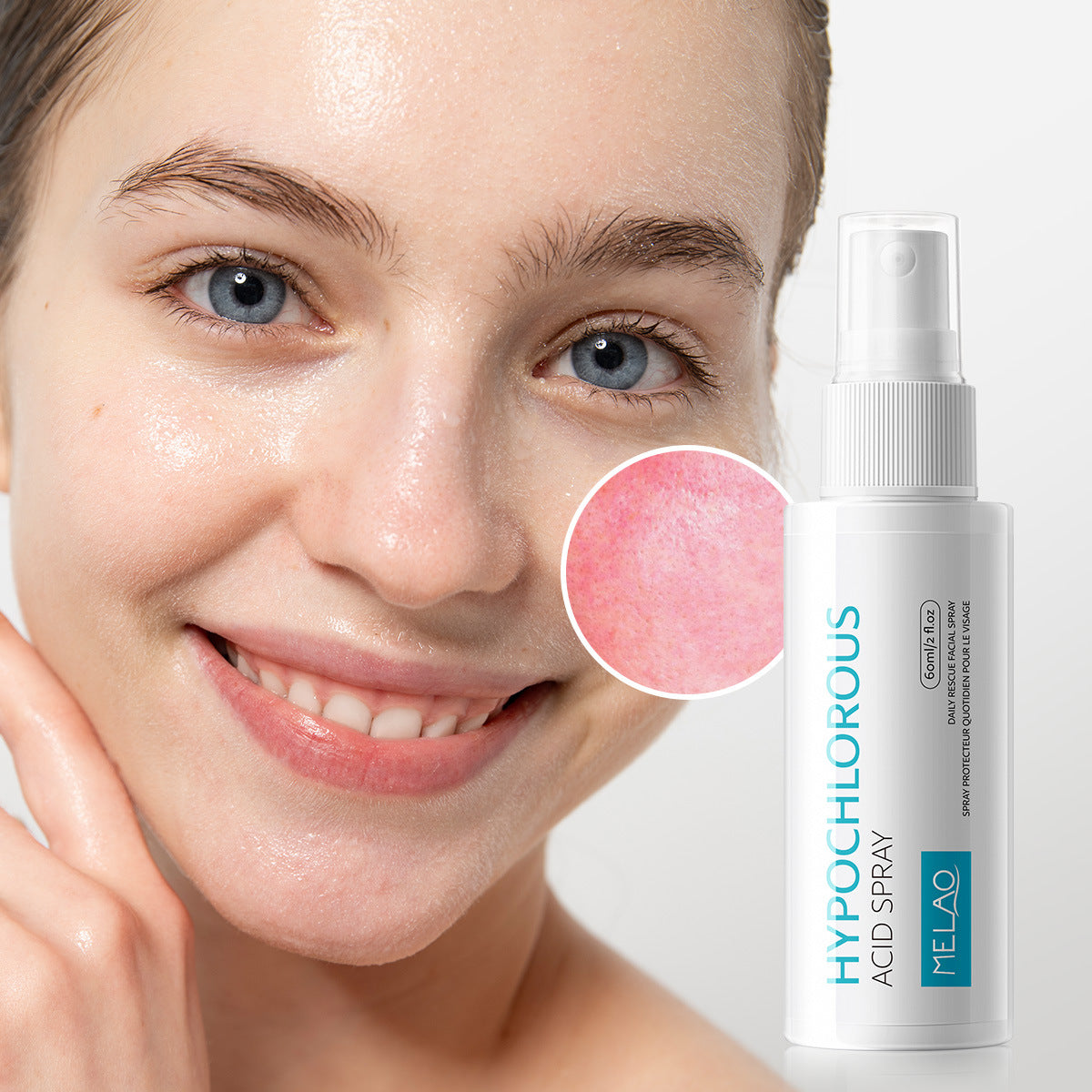 Hypochlorous Acid (HOCl) Rescue Mist – Pure Skin Clearing & Defense